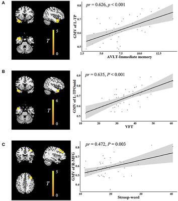 Associations of Neurocognition and Social Cognition With Brain Structure and Function in Early-Onset Schizophrenia